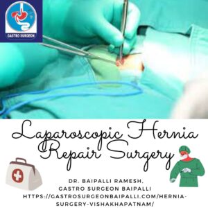 Hernia Laparoscopic Surgery