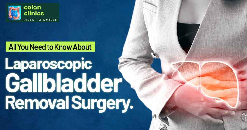 Best Laparoscopic Gallbladder Removal Surgery In Visakhapatnam