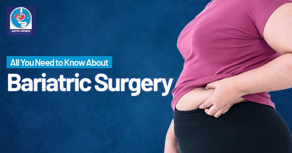 All You Need to Know About Bariatric Surgery