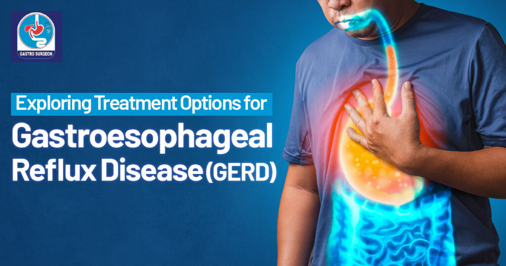 Exploring Treatment Options for Gastroesophageal Reflux Disease (GERD)