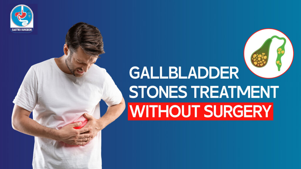 gallbladder stones without surgery