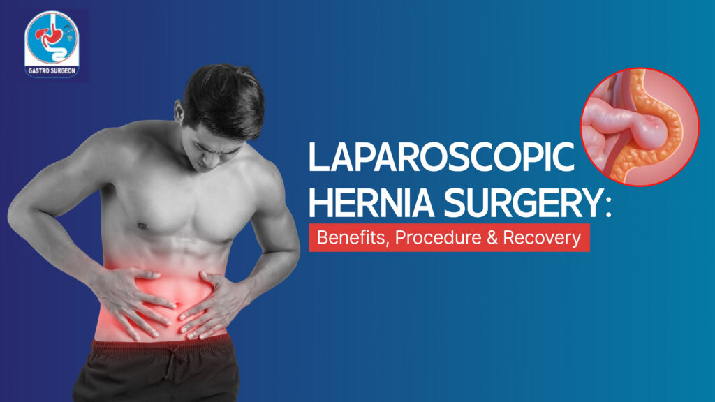 laparoscopic hernia surgery